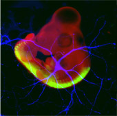 image of a neuron